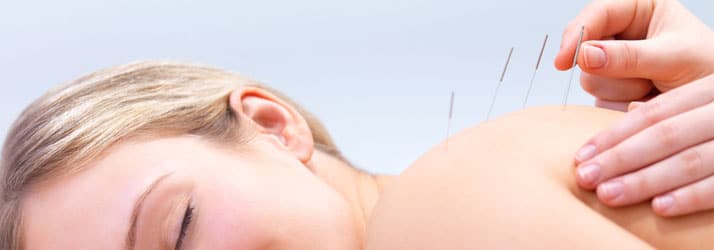 Acupuncture For Chronic Pain